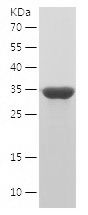 Recombinant Human HEXIM1
