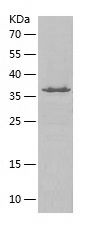 Recombinant Human TIMM44