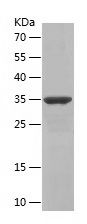 Recombinant Human SRP14
