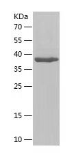 Recombinant Human NDUFB11