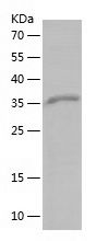 Recombinant Human EIF5A2