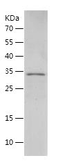 Recombinant Rat IGFBP2