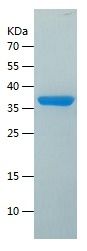 Recombinant Human SULT2B1