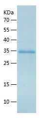 Recombinant Human CHAD