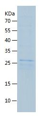 Recombinant Human DKK1