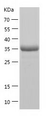 Recombinant Human HEXIM1