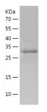 Recombinant Human AHSA1