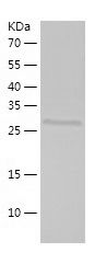 Recombinant Human PCCB