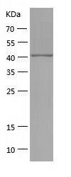 Recombinant Human RB1