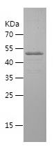 Recombinant Human SOD3