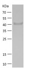 Recombinant Human GALK1