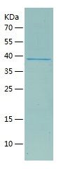 Recombinant Human PPP1CA