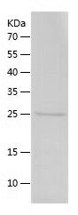 Recombinant Human CXADR