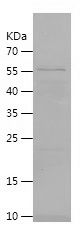 Recombinant Human DNASE1L3