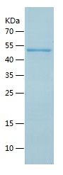 Recombinant Human BLMH