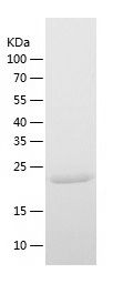 Recombinant Human PARP15