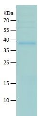 Recombinant Human CDNF