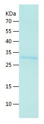 Recombinant Human METRNL