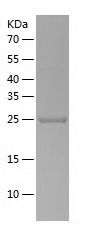 Recombinant Human USP33