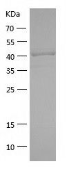 Recombinant Mouse Plxdc1