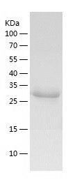 Recombinant Human DCPS