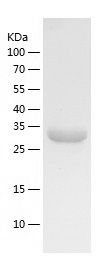 Recombinant Human MAK16