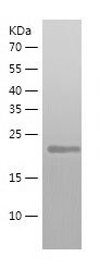 Recombinant Human ATG10