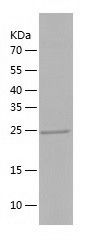 Recombinant Human VTI1B