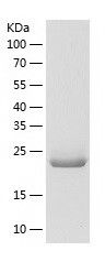 Recombinant Human NFU1