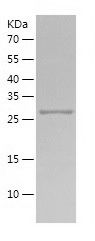 Recombinant Human KCNIP3