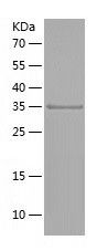 Recombinant Human NDUFAF1