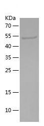 Recombinant Human USP15