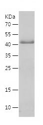 Recombinant Human CALN1