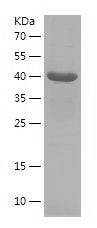 Recombinant Human ASRGL1