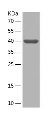 Recombinant Human FA2H