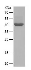 Recombinant Human PCCA