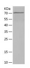 Recombinant Human ODC1