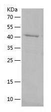 Recombinant Human SESN1