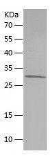 Recombinant Human HIF1A