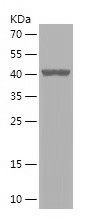 Recombinant Human SLC25A5