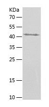 Recombinant Human STAC3