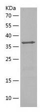 Recombinant Human GMFG