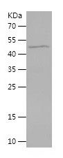 Recombinant Human PDCD2