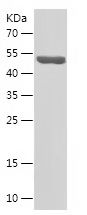 Recombinant Human KDM1A