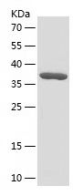 Recombinant Human MAP1LC3C