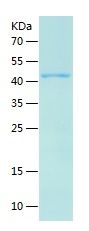 Recombinant Human TPT1