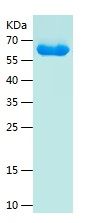 Recombinant Human ARHGEF10