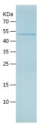 Recombinant Human CDCA3