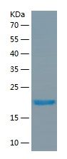 Recombinant Human RTN4R