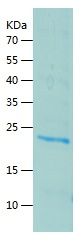 Recombinant Human FKBP14